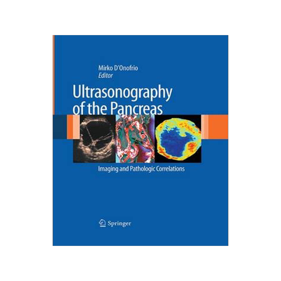 预订 Ultrasonography of the Pancreas