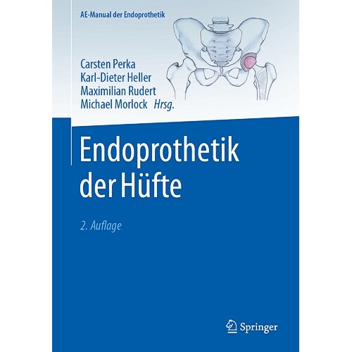预订 Endoprothetik der Hüfte 9783662686164