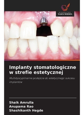 预订 Implanty stomatologiczne w strefie estetycznej: Multidyscyplinarne podejscie do estetycznego sukcesu implantów. DE