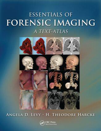 【预订】Essentials of Forensic Imaging