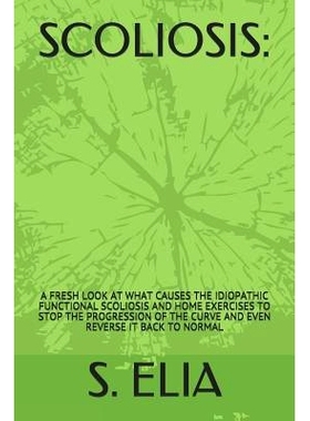预订 Scoliosis: : A Fresh Look at What Causes the Idiopathic Functional Scoliosis and Home Exercises to S* the Progres