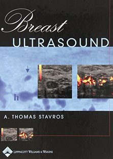 Ultrasound Breast 预订