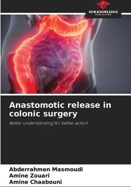 [预订]Anastomotic release in colonic surgery 9786205927403
