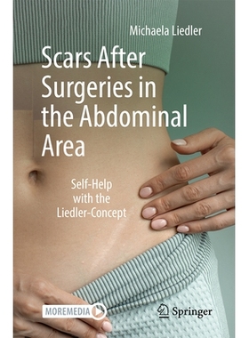 预订 Scars After Surgeries in the Abdominal Area: Self-Help with the Liedler-Concept 腹部手术后疤痕：基于利德勒理念的自