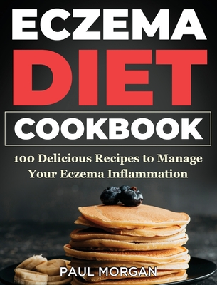 【预订】Eczema DIet Cookbook: 100 Delicious Recipes to Manage your Eczema Inflammation