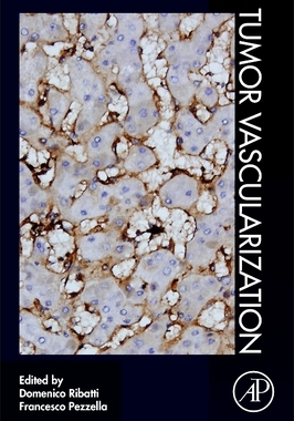 【预订】Tumor Vascularization