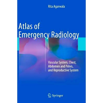 预订 Atlas of Emergency Radiology: Vascular System, Chest, Abdomen and Pelvis, and Reproductive System 急诊放射图集：血