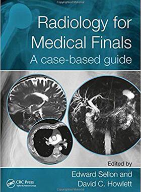 预订 【】Radiology for Medical Finals