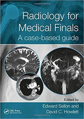 预订 【】Radiology for Medical Finals