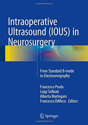 【预订】Intraoperative Ultrasound (IOUS) in Neurosurgery