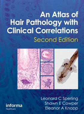 【预订】An Atlas of Hair Pathology with Clinical Correlations, Second Edition