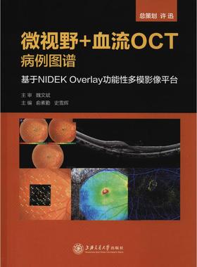 微视野+血流OCT病例图谱 基于NIDEK Overlay功能性多模影像平台  9787313200228