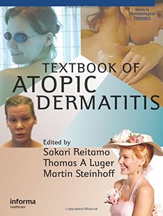 【预订】Textbook of Atopic Dermatitis