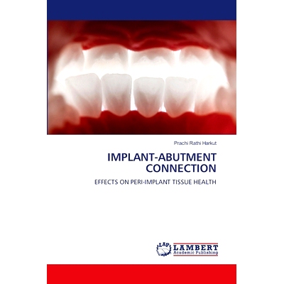 预订 Implant-Abutment Connection IMPLANT-ABUTMENT连接: 9786208116804