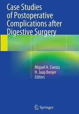预订 Case Studies of Postoperative Complications after Digestive Surgery