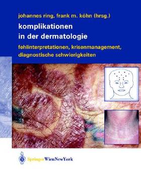 预订 Fallstricke Und Fehlerquellen in Der Dermatologie