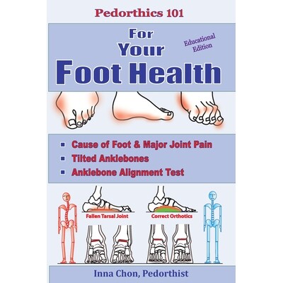 预订 Pedorthics 101 for Your Foot Health: Cause of Foot & Major Joint Pain, Tilted Anklebones, Anklebone Alignment Test
