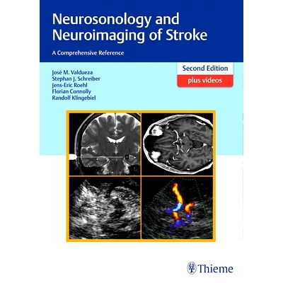 预订 Neurosonology and Neuroimaging of Stroke: A Comprehensive Reference 脑卒中神经科学和神经影像学：综合参考: 978313141