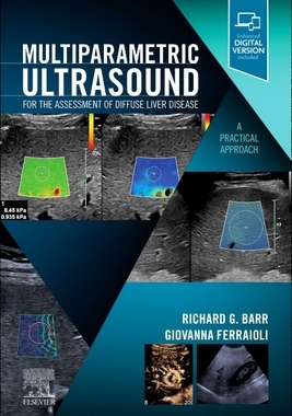 【预订】Multiparametric Ultrasound for the Assessment of Diffuse Liver Disea 9780323874793