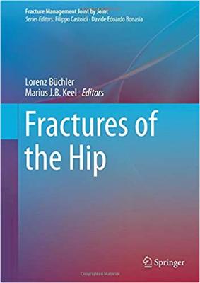【预售】Fractures of the Hip
