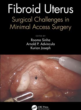 【预订】Fibroid Uterus 9780367620554