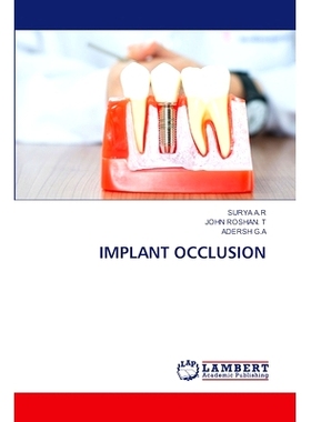 预订 Implant Occlusion: 9786207652693