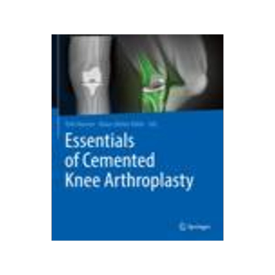 [预订]Essentials of Cemented Knee Arthroplasty