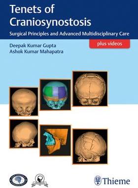 [预订]Tenets of Craniosynostosis 9789386293565