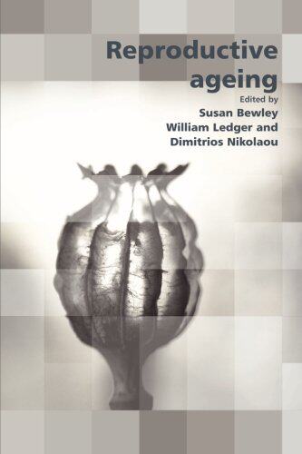 【预订】Reproductive Ageing