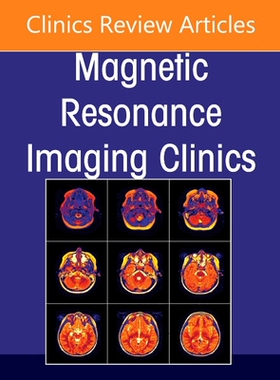 【预订】MR Imaging of Chronic Liver Diseases and Liver Cancer, an Issue of Magnetic Resonance  9780323776134