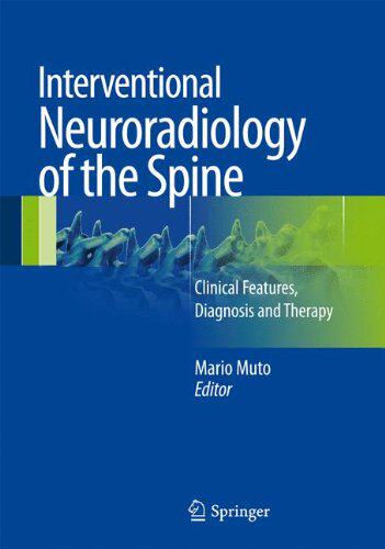 【预订】Interventional Neuroradiology of the Spine