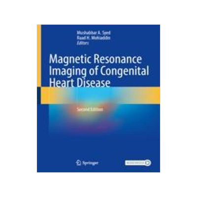 [预订]Magnetic Resonance Imaging of Congenital Heart Disease 9783031292347