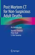 Non 9783030708283 Post Deaths Adult Suspicious for Mortem 预订