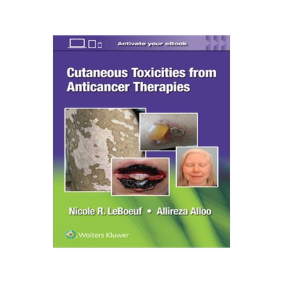 [预订]Cutaneous Reactions from Anti-Cancer Therapies 9781975157890