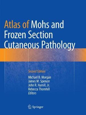 【预订】Atlas of Mohs and Frozen Section Cutaneous Pathology