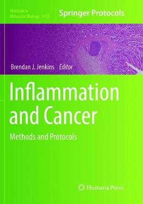 【预订】Inflammation and Cancer: Methods and Protocols