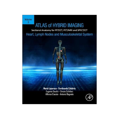 [预订]Atlas of Hybrid Imaging Sectional Anatomy for Pet/Ct, Pet/MRI and Spect/CT Vol. 3 9780443188183