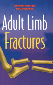 Adult Limb Fractures 预订