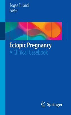 【预订】Ectopic Pregnancy