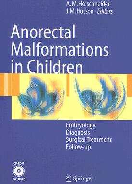【预订】Anorectal Malformations in Children