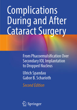[预订]Complications During and After Cataract Surgery