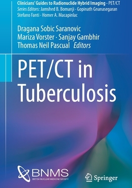 【预订】PET/CT in Tuberculosis