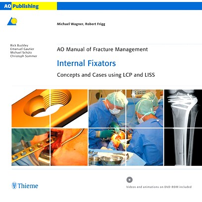 预订 AO Manual of Fracture Management: Internal Fixators: Concepts and Cases using LCP/LISS 骨折管理手册：内固定器: 9783