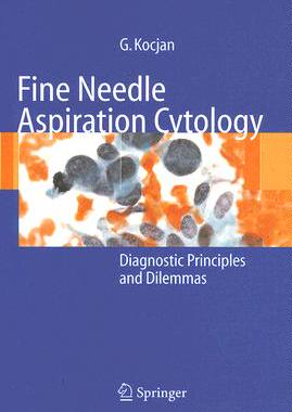 【预订】Fine Needle Aspiration Cytology