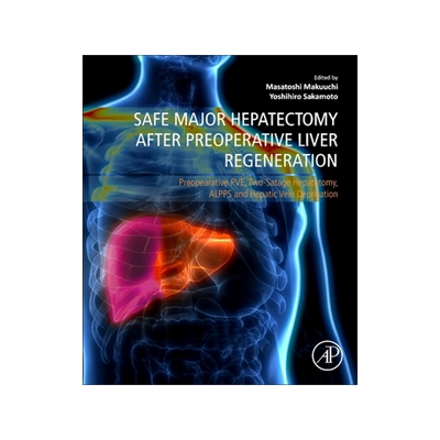 预订 Safe Major Hepatectomy After Preoperative Liver Regeneration