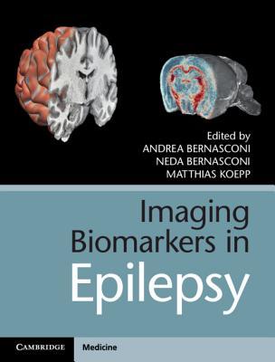 【预订】Imaging Biomarkers in Epilepsy