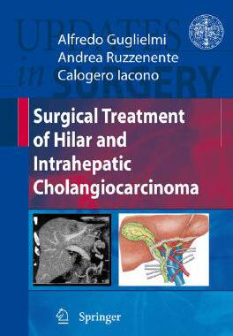 【预订】Surgical Treatment of Hilar and Intrahepatic Cholangiocarcinoma
