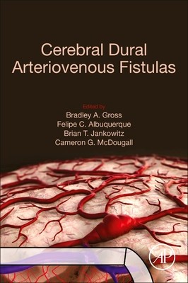 【预订】Cerebral Dural Arteriovenous Fistulas