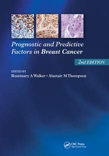 and Predictive Factors Breast Prognostic Cancer 预订
