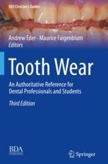 [预订]Tooth Wear: An Authoritative Reference for Dental Professionals and Students 9783030861124
